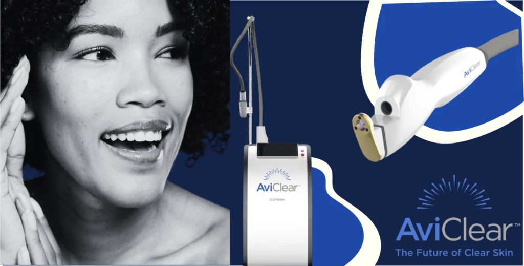 AviClear laser treatment at Sharkra Medi Spa in Hobart